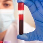 What are the Top Benefits of Regular Blood Testing?