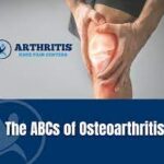 arthritis knee pain center