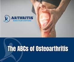 arthritis knee pain center